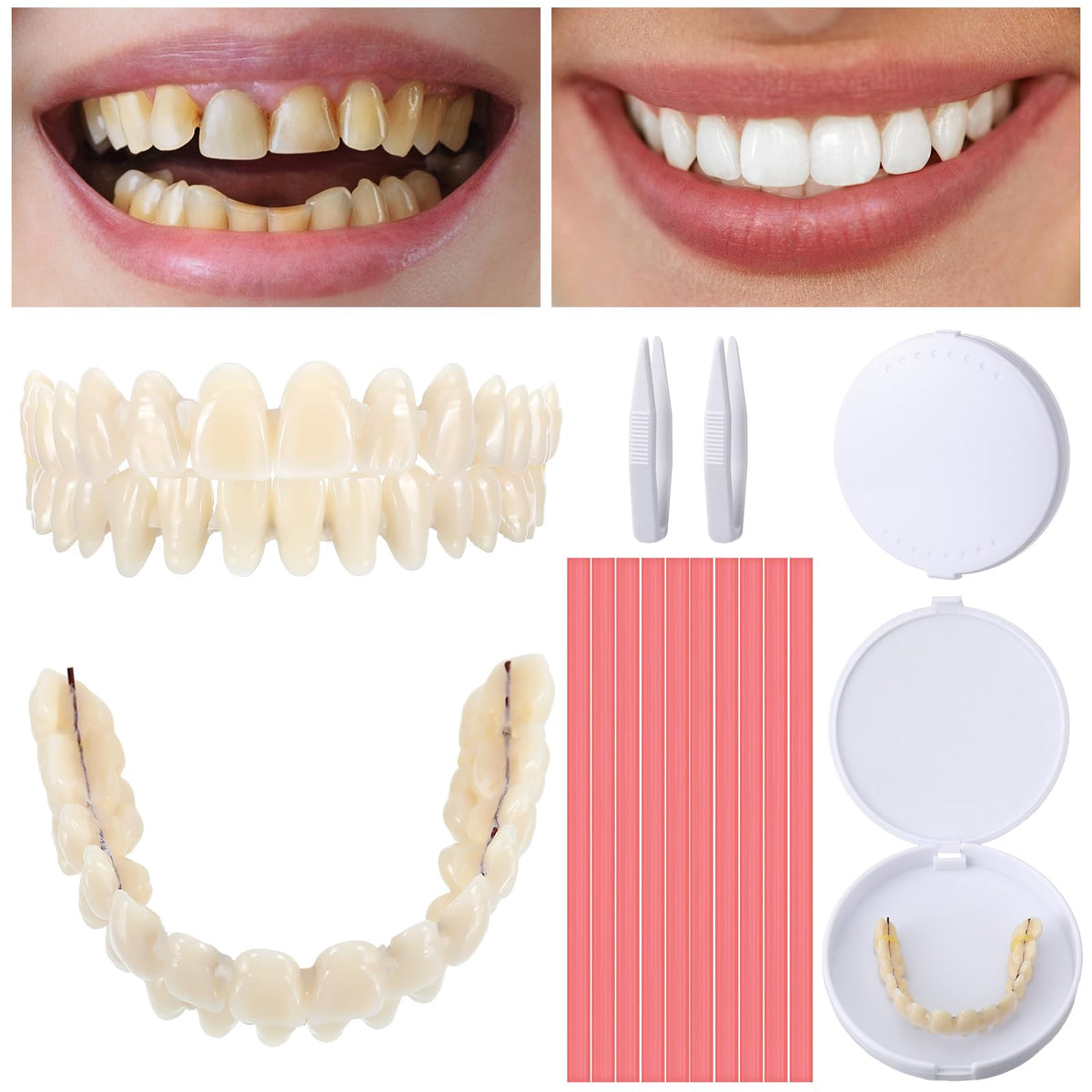 16 Pcs Dentures DIY Repair Kit F987227